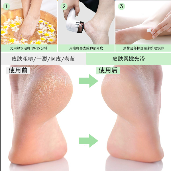 Anti-Dust Electric Foot File Type-C Charging Waterproof Callus Dead Skin Remover Pedicure Tool New Foot Care Custom