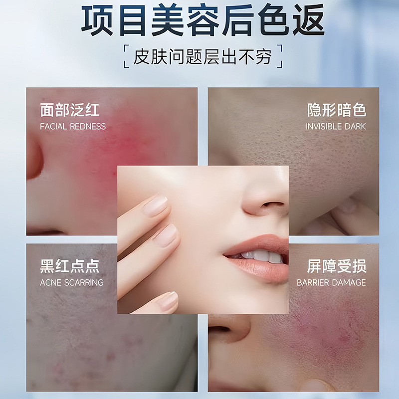 Zhipu Porcelain Glow Whitening Spot-Correcting Essence Water Improve Dull Skin Hydrating Moisturizing Brighten Skin Tone Niacinamide